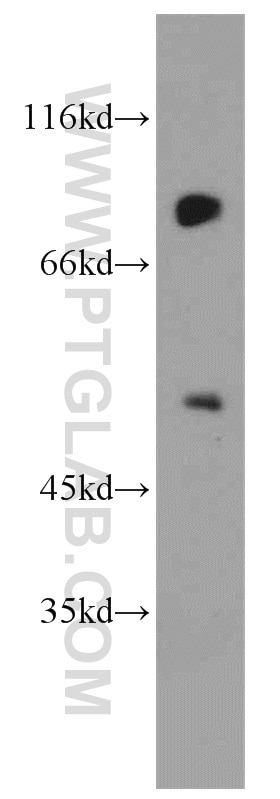 Western Blot (WB) analysis of MCF-7 cells using USP49 Polyclonal antibody (18066-1-AP)