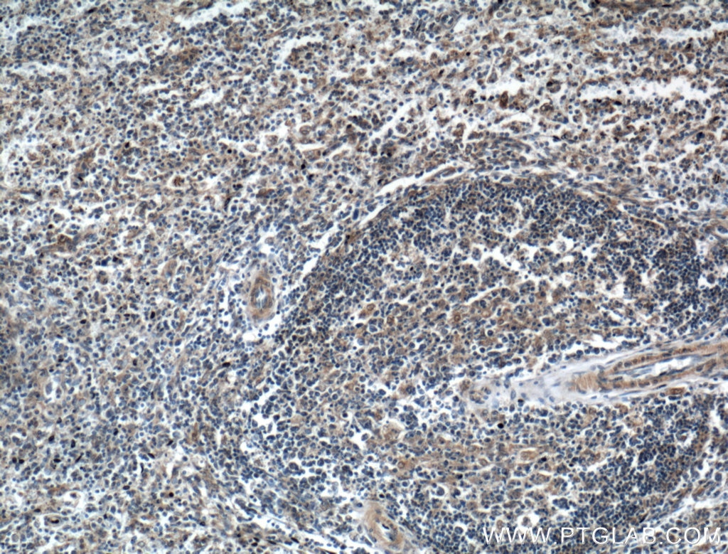 Immunohistochemistry (IHC) staining of human spleen tissue using USP5 Polyclonal antibody (10473-1-AP)