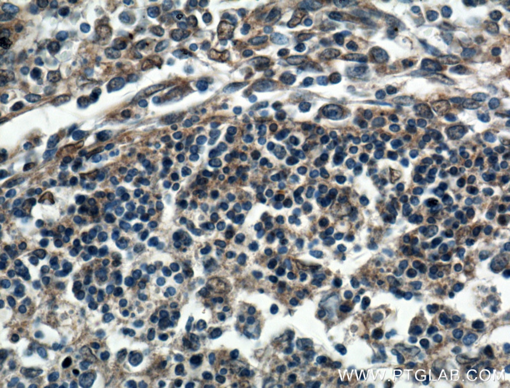 Immunohistochemistry (IHC) staining of human spleen tissue using USP5 Polyclonal antibody (10473-1-AP)