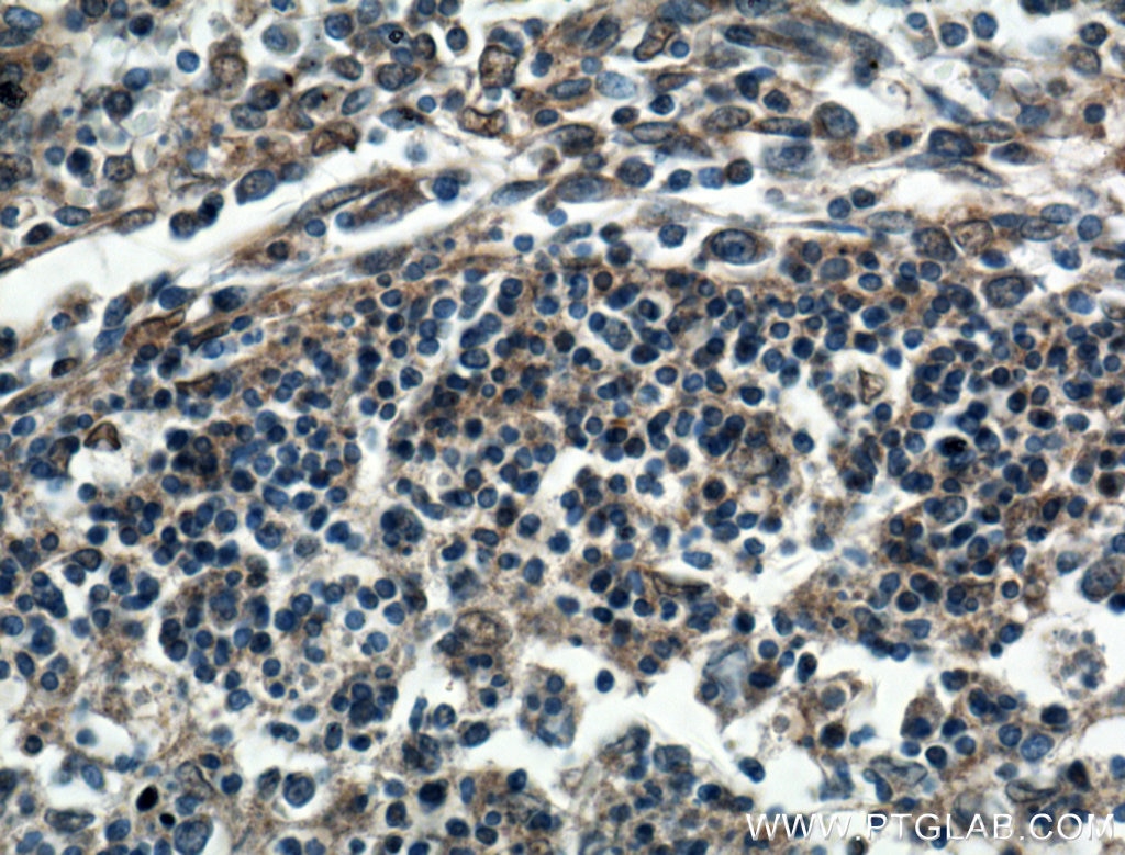 IHC staining of human spleen using 10473-1-AP