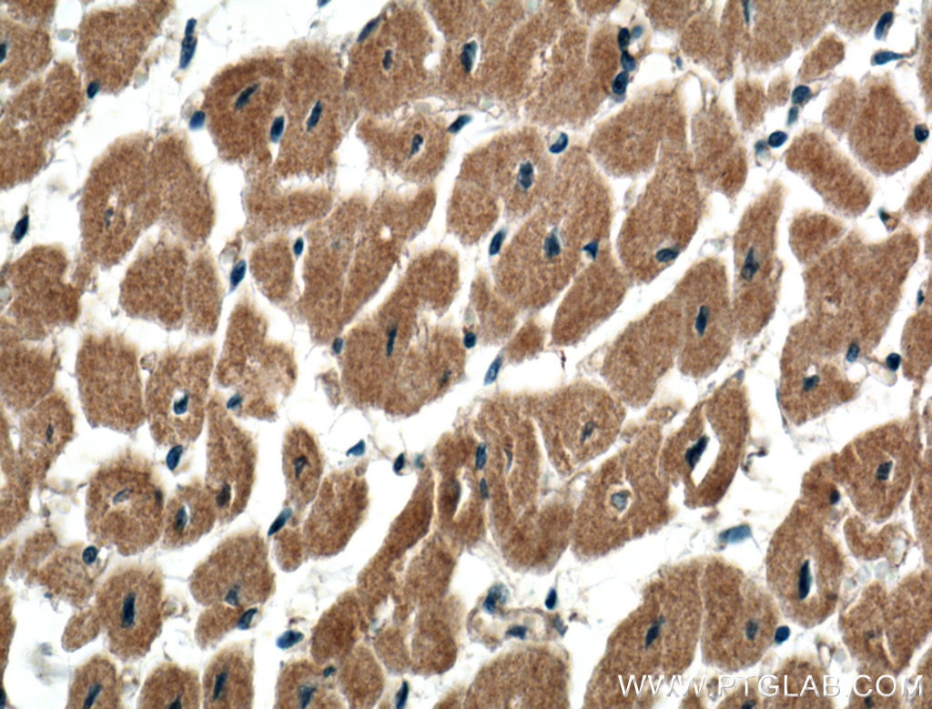 Immunohistochemistry (IHC) staining of human heart tissue using USP5 Polyclonal antibody (10473-1-AP)