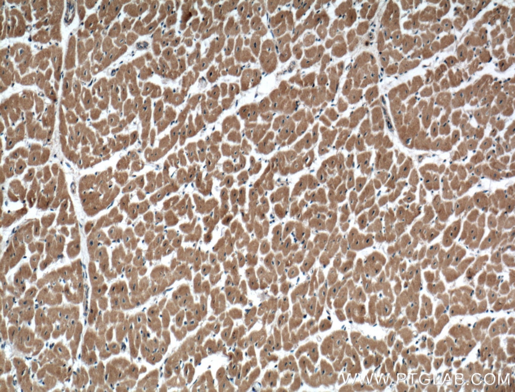 Immunohistochemistry (IHC) staining of human heart tissue using USP5 Polyclonal antibody (10473-1-AP)