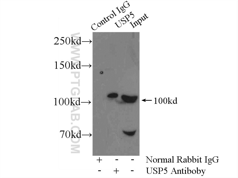 Immunoprecipitation (IP) experiment of mouse brain tissue using USP5 Polyclonal antibody (10473-1-AP)