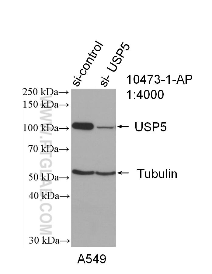 Western Blot (WB) analysis of A549 cells using USP5 Polyclonal antibody (10473-1-AP)