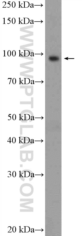 WB analysis of MDA-MB-453s using 10473-1-AP