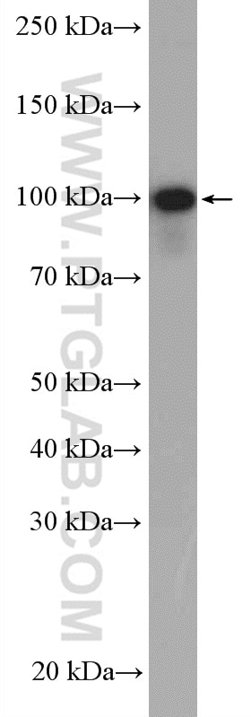 Western Blot (WB) analysis of A549 cells using USP5 Polyclonal antibody (10473-1-AP)