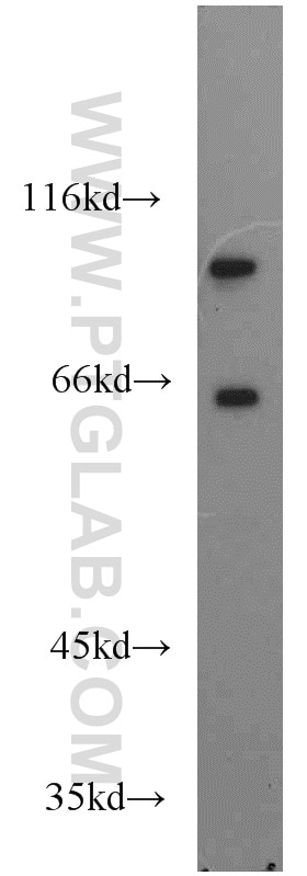 Western Blot (WB) analysis of mouse brain tissue using USP5 Polyclonal antibody (10473-1-AP)