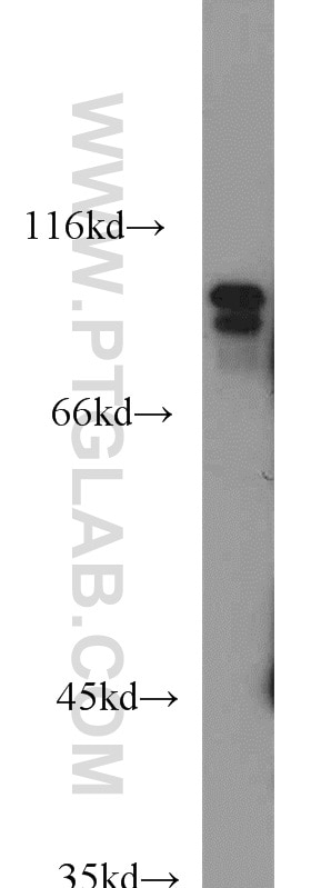 Western Blot (WB) analysis of human heart tissue using USP5 Polyclonal antibody (10473-1-AP)