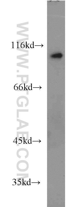 Western Blot (WB) analysis of human colon tissue using USP5 Polyclonal antibody (10473-1-AP)