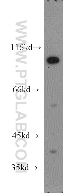 Western Blot (WB) analysis of DU 145 cells using USP5 Polyclonal antibody (10473-1-AP)