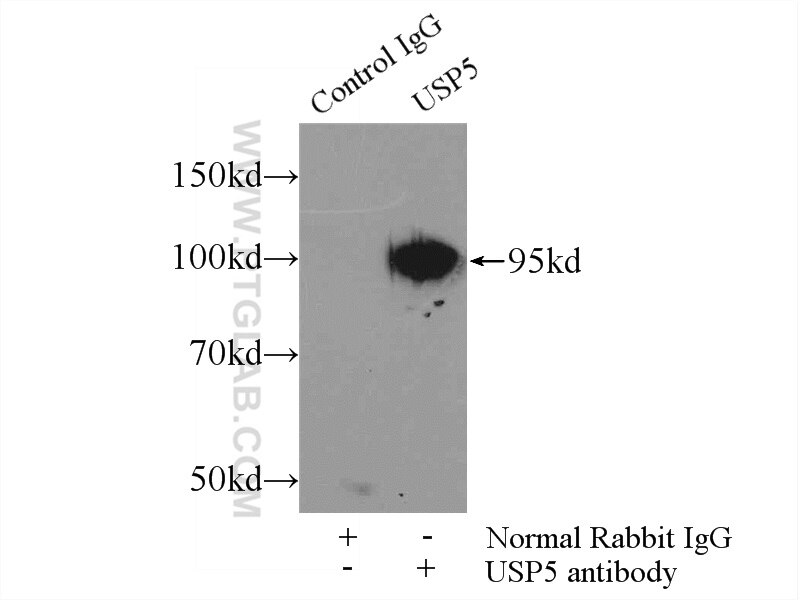 Immunoprecipitation (IP) experiment of mouse brain tissue using USP5 Polyclonal antibody (15158-1-AP)