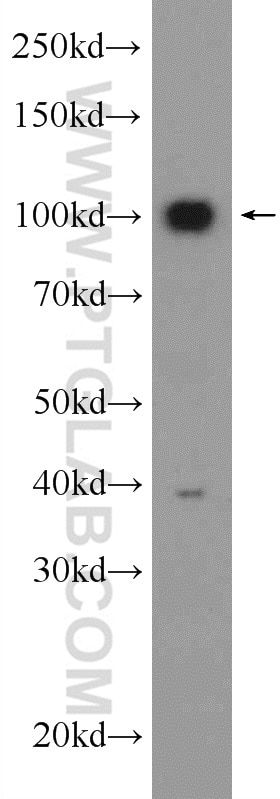 Western Blot (WB) analysis of rat brain tissue using USP5 Polyclonal antibody (15158-1-AP)