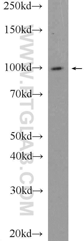 Western Blot (WB) analysis of rat lung tissue using USP5 Polyclonal antibody (15158-1-AP)