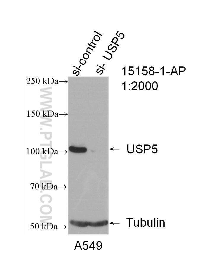 Western Blot (WB) analysis of A549 cells using USP5 Polyclonal antibody (15158-1-AP)