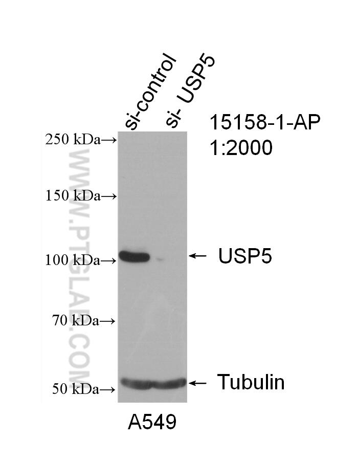 WB analysis of A549 using 15158-1-AP