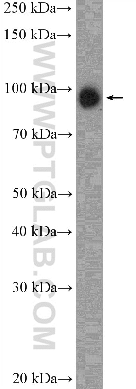 Western Blot (WB) analysis of MDA-MB-453s cells using USP5 Polyclonal antibody (15158-1-AP)