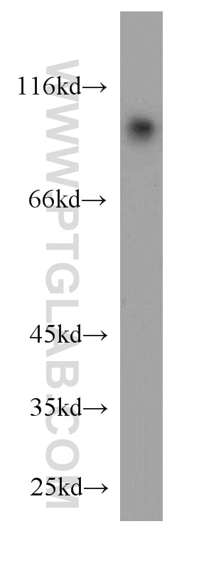 Western Blot (WB) analysis of human brain tissue using USP5 Polyclonal antibody (15158-1-AP)