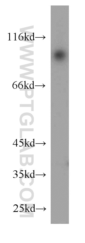 Western Blot (WB) analysis of human brain tissue using USP5 Polyclonal antibody (15158-1-AP)