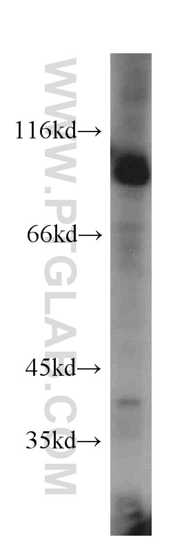 WB analysis of HeLa using 15158-1-AP