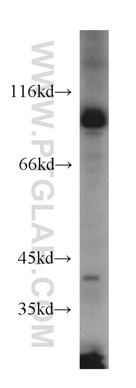 Western Blot (WB) analysis of HeLa cells using USP5 Polyclonal antibody (15158-1-AP)