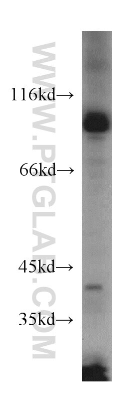 WB analysis of HeLa using 15158-1-AP