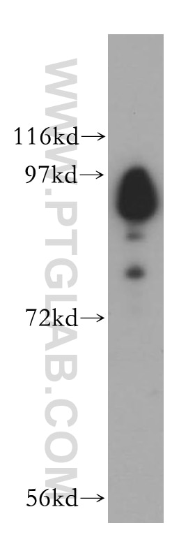 Western Blot (WB) analysis of HeLa cells using USP5 Polyclonal antibody (15158-1-AP)