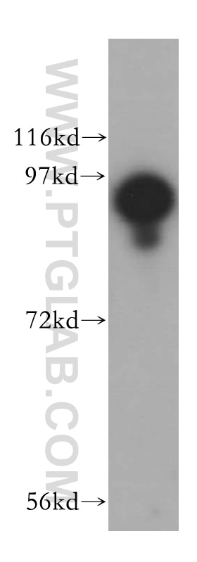 Western Blot (WB) analysis of mouse lung tissue using USP5 Polyclonal antibody (15158-1-AP)