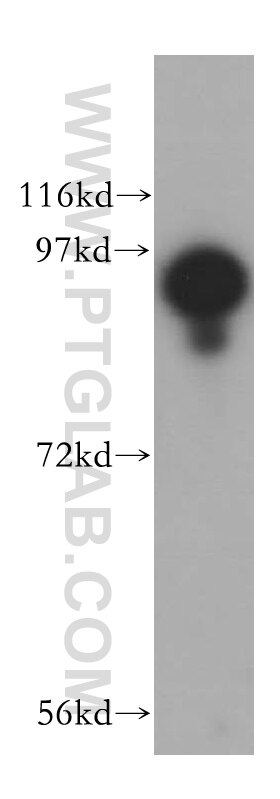 Western Blot (WB) analysis of mouse lung tissue using USP5 Polyclonal antibody (15158-1-AP)