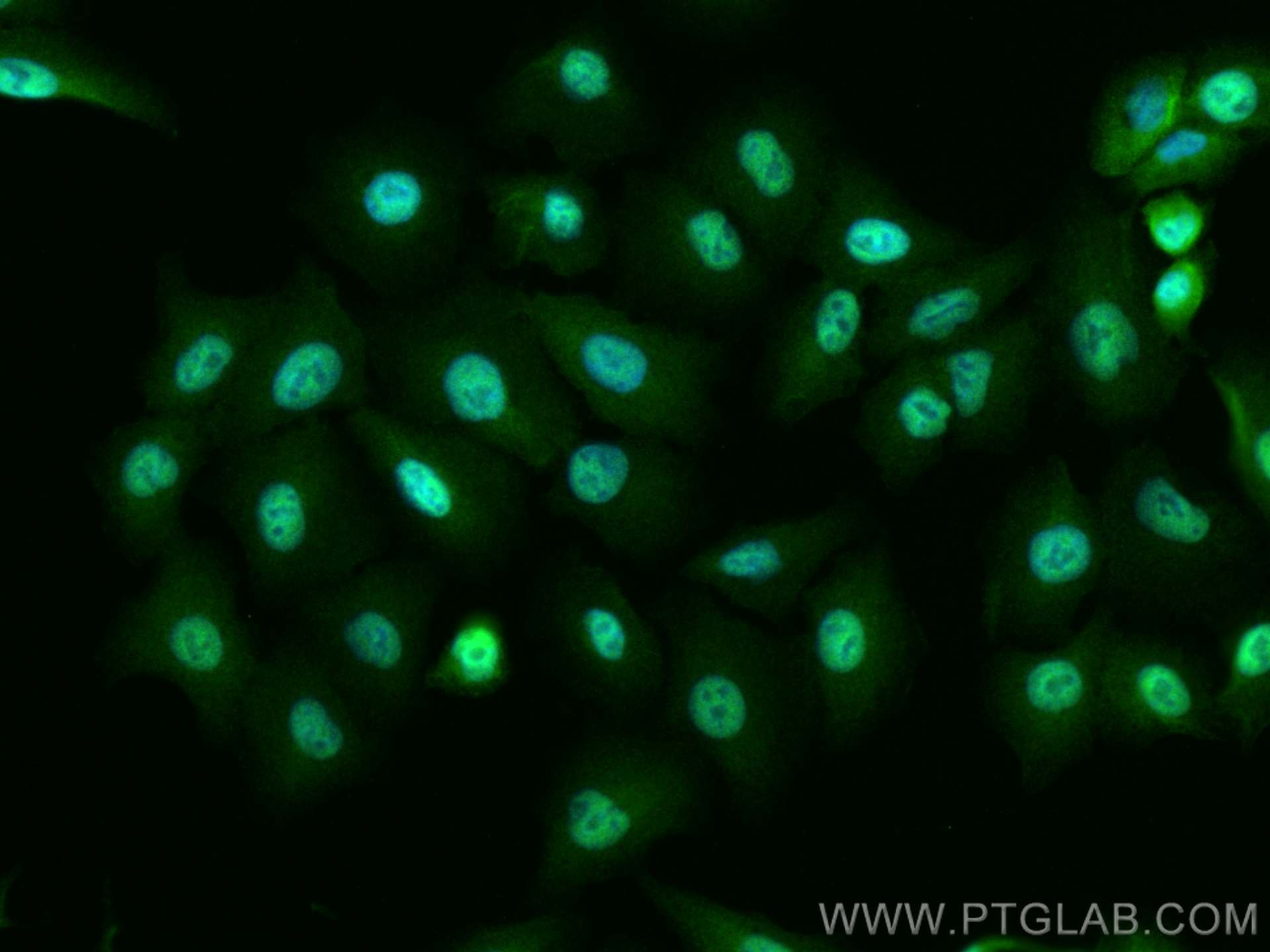 Immunofluorescence (IF) / fluorescent staining of A549 cells using USP5 Monoclonal antibody (66213-1-Ig)