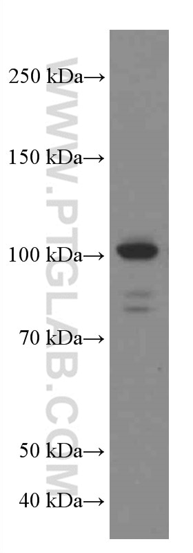 Western Blot (WB) analysis of HeLa cells using USP5 Monoclonal antibody (66213-1-Ig)