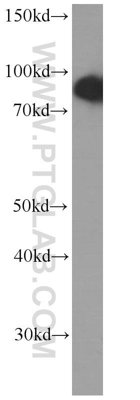 Western Blot (WB) analysis of HeLa cells using USP5 Monoclonal antibody (66213-1-Ig)