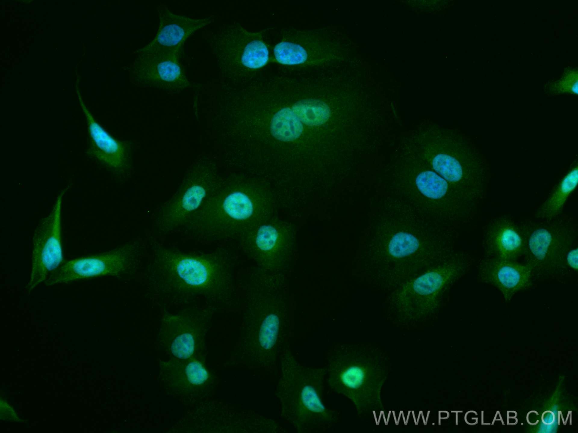 Immunofluorescence (IF) / fluorescent staining of A549 cells using CoraLite® Plus 488-conjugated USP5 Monoclonal anti (CL488-66213)