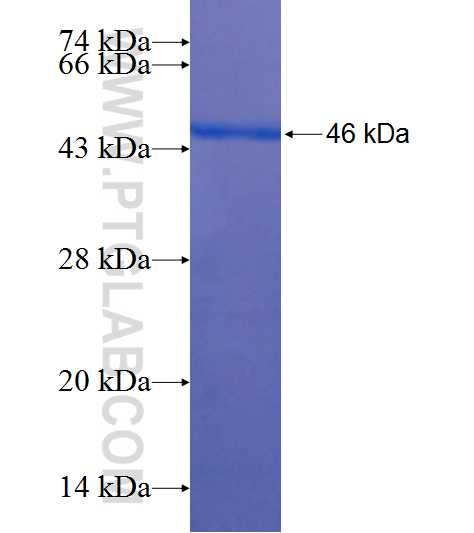 USP5 fusion protein Ag7575 SDS-PAGE