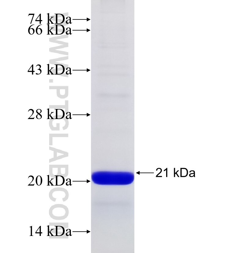 USP50 fusion protein Ag31275 SDS-PAGE