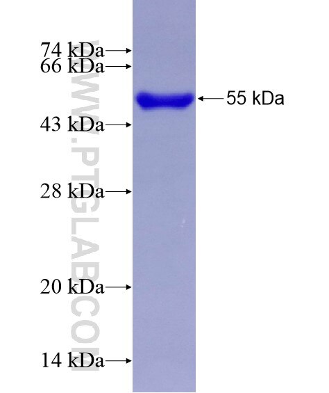 USP53 fusion protein Ag28923 SDS-PAGE