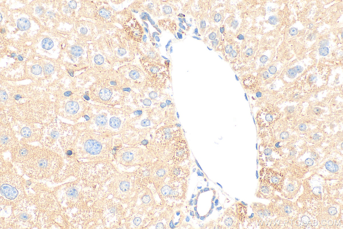 Immunohistochemistry (IHC) staining of mouse liver tissue using USP54 Polyclonal antibody (26707-1-AP)