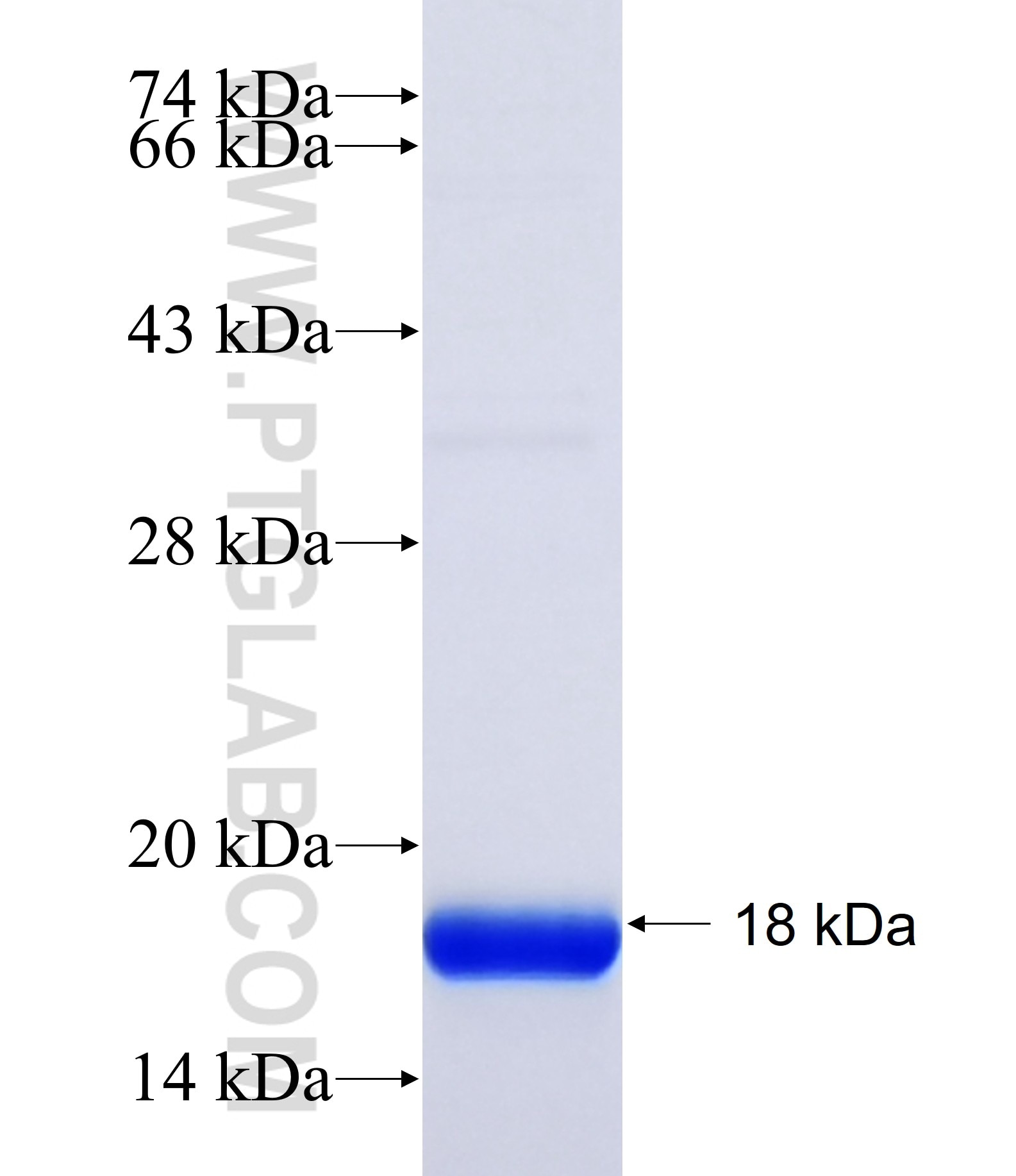 USP6 fusion protein Ag38024 SDS-PAGE USP6 fusion protein Ag38024 SDS-PAGE