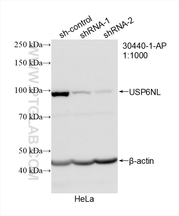 Western Blot (WB) analysis of HeLa cells using USP6NL Polyclonal antibody (30440-1-AP)