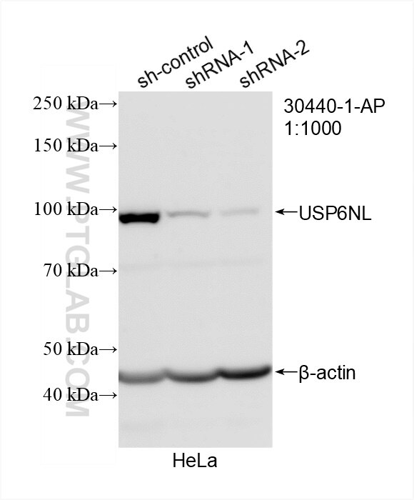 WB analysis of HeLa using 30440-1-AP