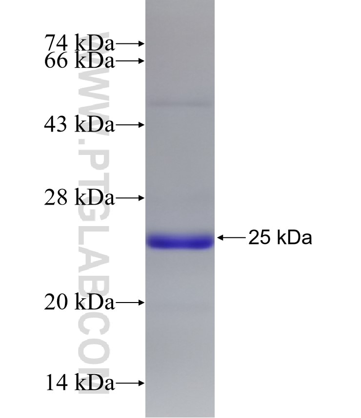 USP6NL fusion protein Ag32597 SDS-PAGE USP6NL fusion protein Ag32597 SDS-PAGE