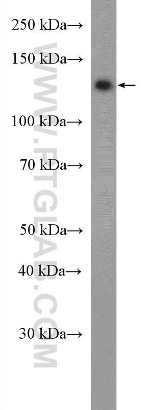 Western Blot (WB) analysis of U2OS cells using USP7 Polyclonal antibody (26948-1-AP)