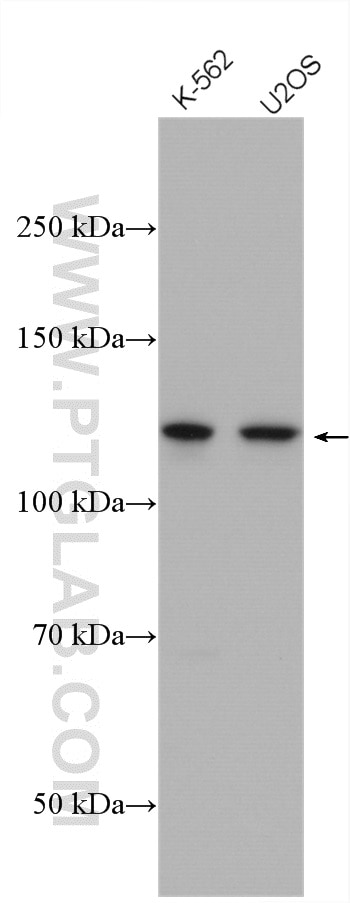 Western Blot (WB) analysis of various lysates using USP7 Polyclonal antibody (26948-1-AP)