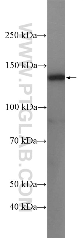 Western Blot (WB) analysis of U2OS cells using USP7 Polyclonal antibody (26948-1-AP)