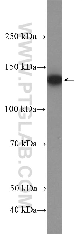 Western Blot (WB) analysis of K-562 cells using USP7 Polyclonal antibody (26948-1-AP)