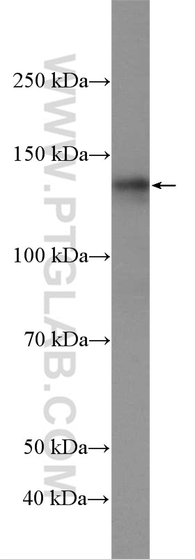 Western Blot (WB) analysis of mouse spleen tissue using USP7 Polyclonal antibody (26948-1-AP)