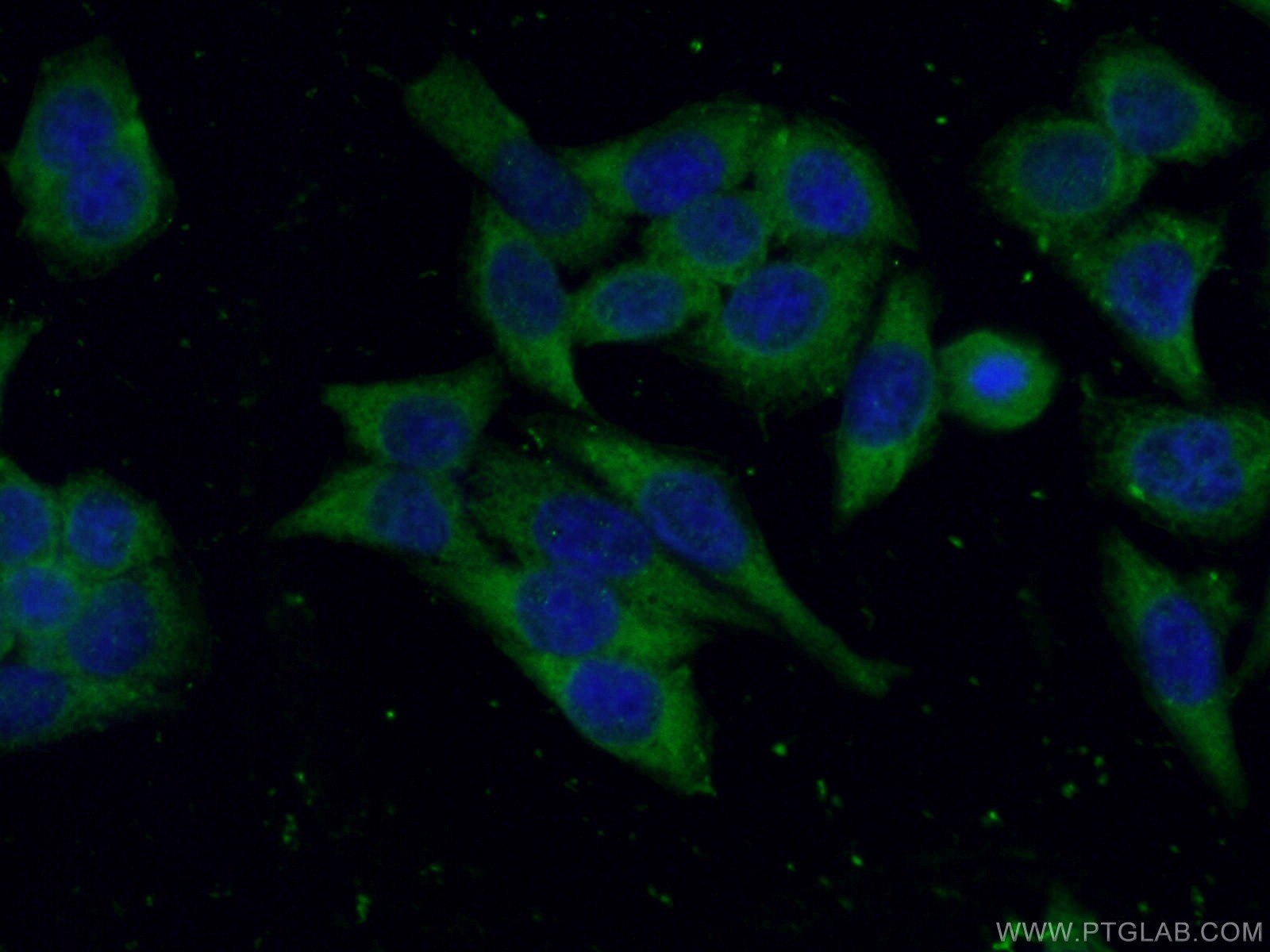 Immunofluorescence (IF) / fluorescent staining of HeLa cells using USP7 Monoclonal antibody (66514-1-Ig)