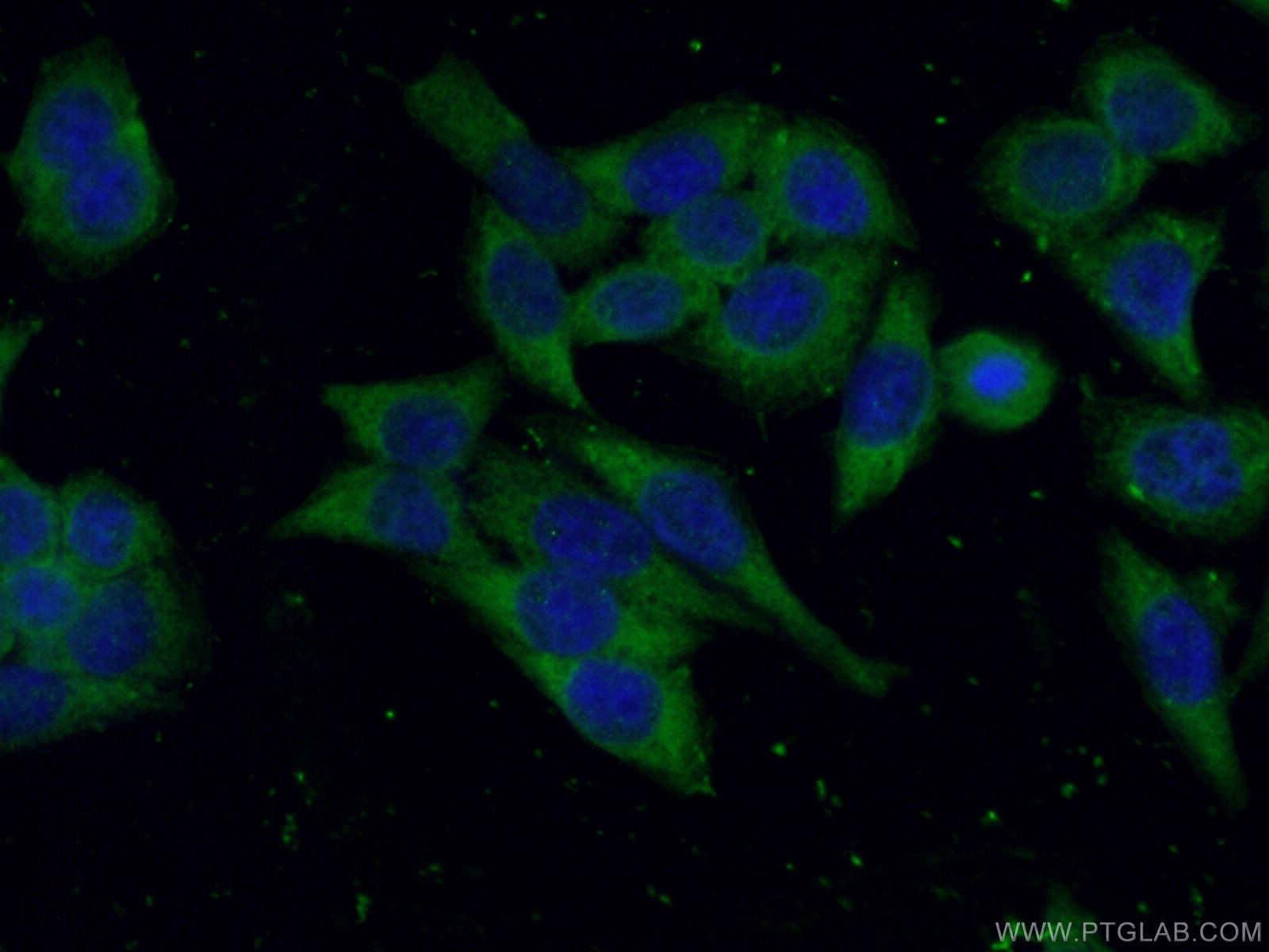 IF Staining of HeLa using 66514-1-Ig