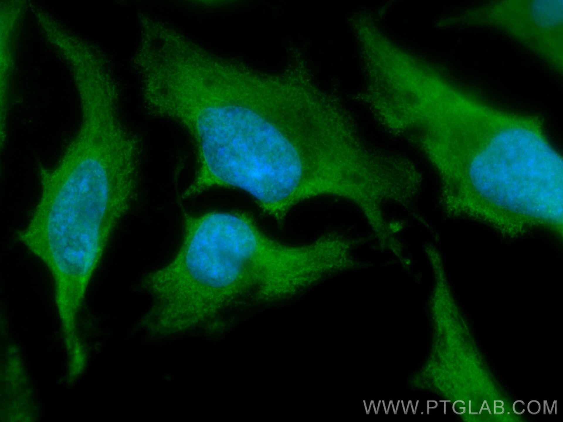 Immunofluorescence (IF) / fluorescent staining of HeLa cells using CoraLite® Plus 488-conjugated USP7 Monoclonal anti (CL488-66514)