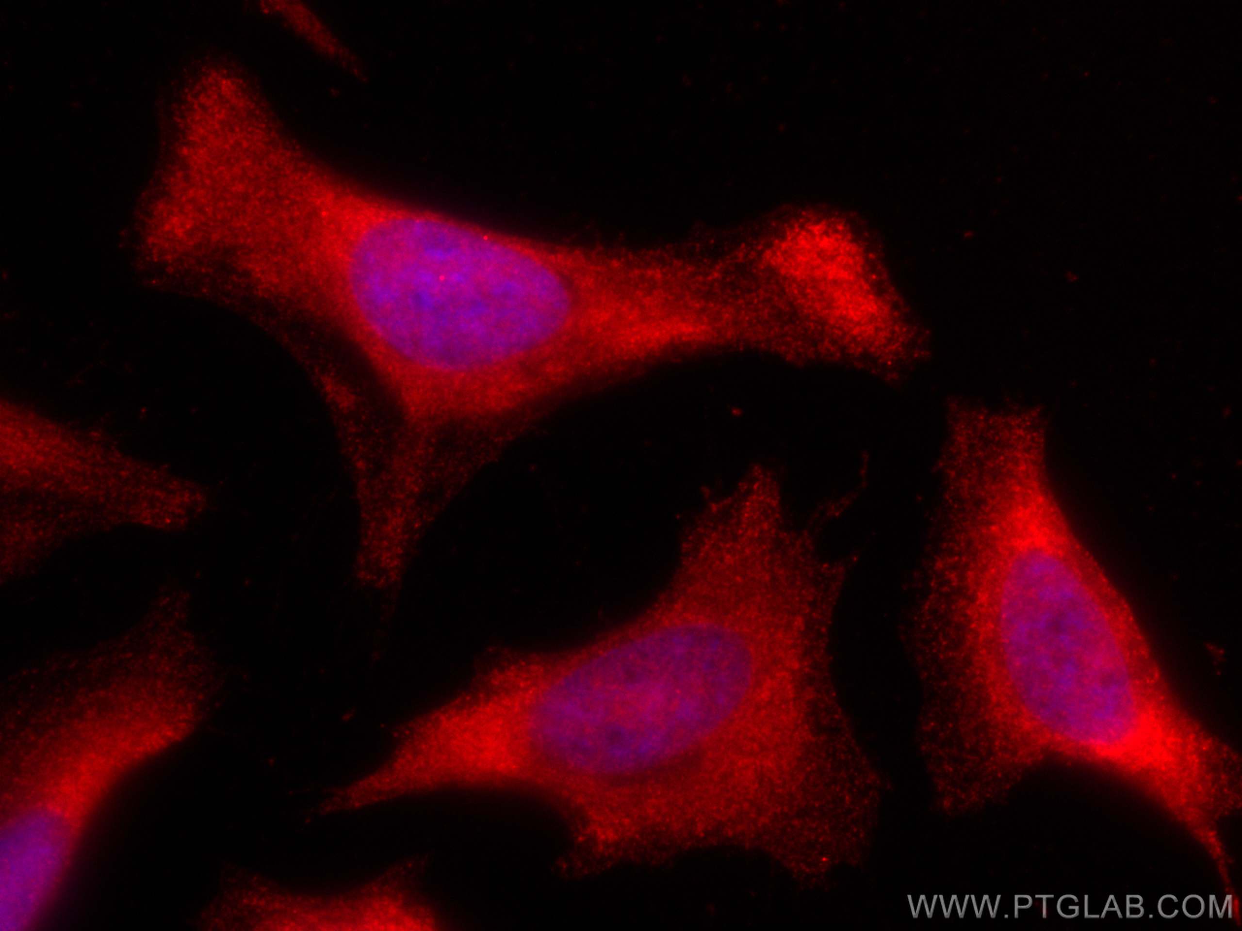 IF Staining of HeLa using CL594-66514