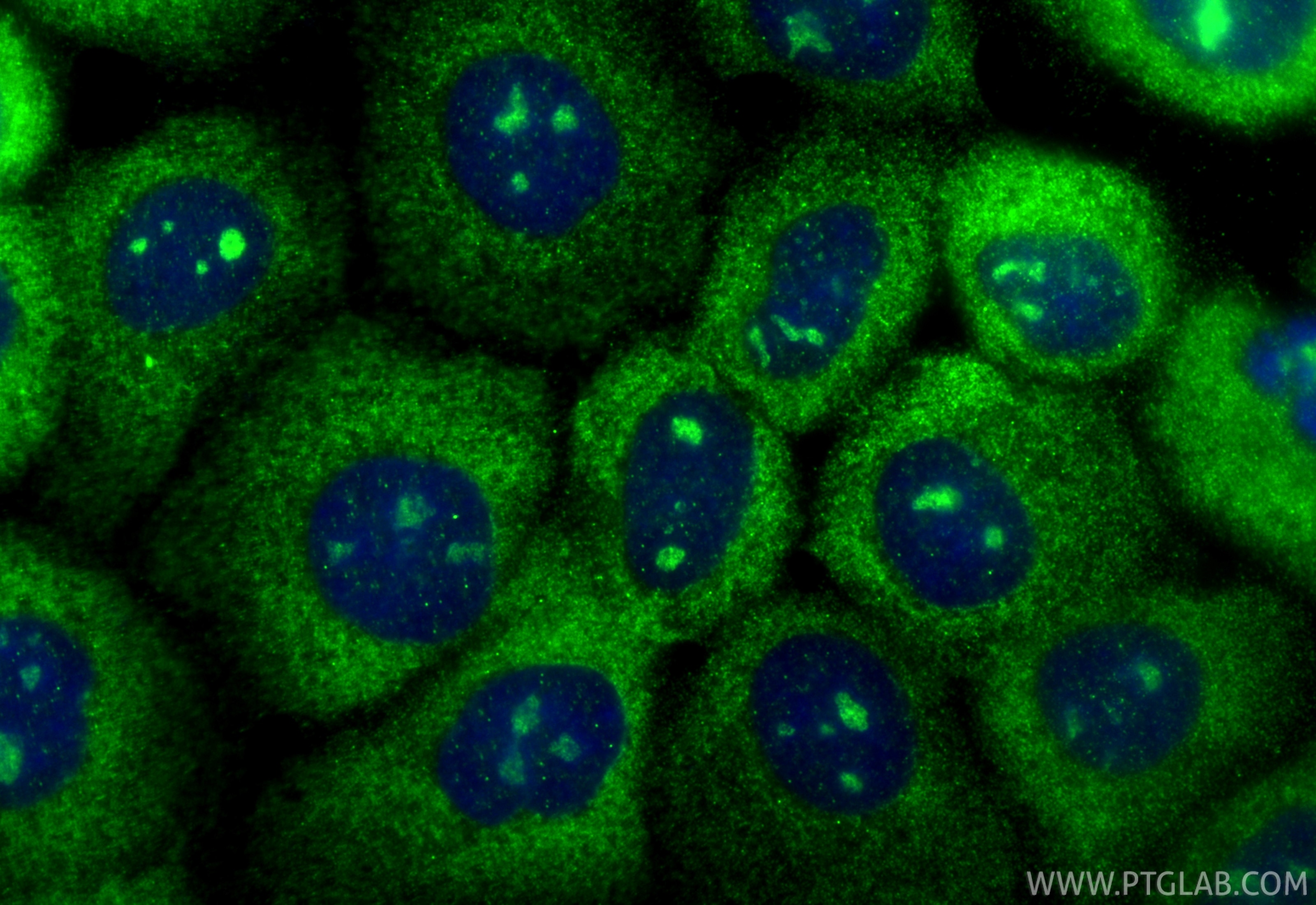 Immunofluorescent analysis of (-20°C Ethanol) fixed A431 cells using USP8 antibody (27791-1-AP) at dilution of 1:200 and CoraLite®488-Conjugated Goat Anti-Rabbit IgG(H+L) (SA00013-2). Immunofluorescence (IF) / fluorescent staining of A431 cells using USP8 Polyclonal antibody (27791-1-AP)